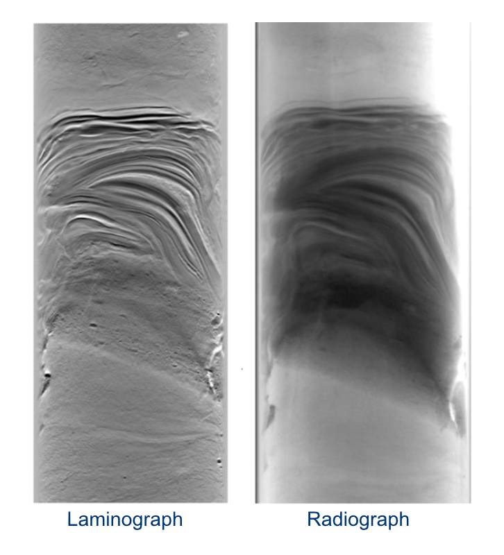Laminograph compared with radiograph