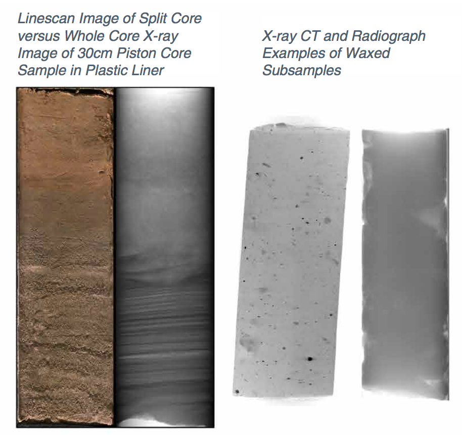 X-ray Radiography & CT slice