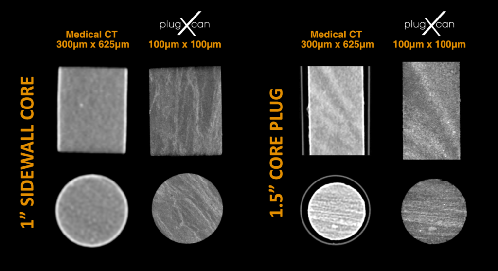 Medical CT data compared with PlugXcan data